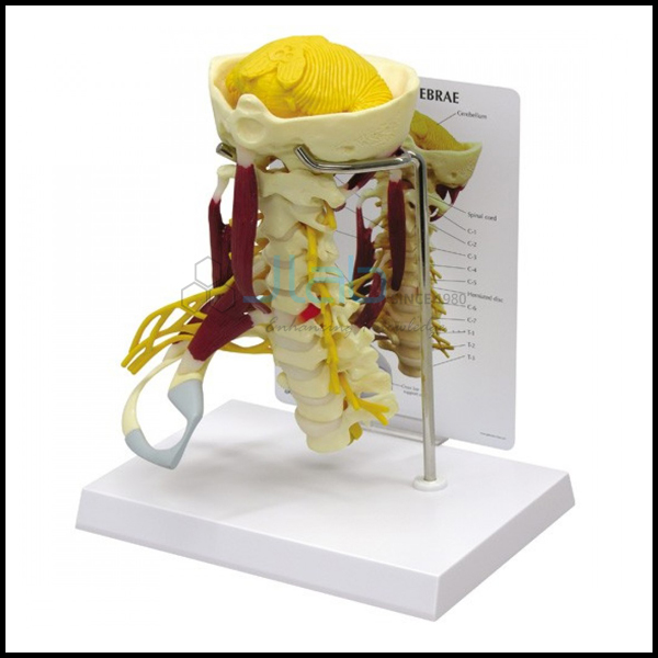颈椎模型