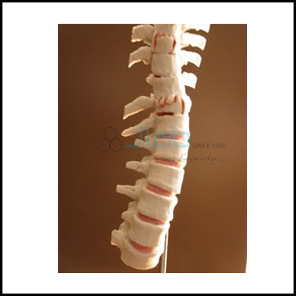 脊柱骨折模型