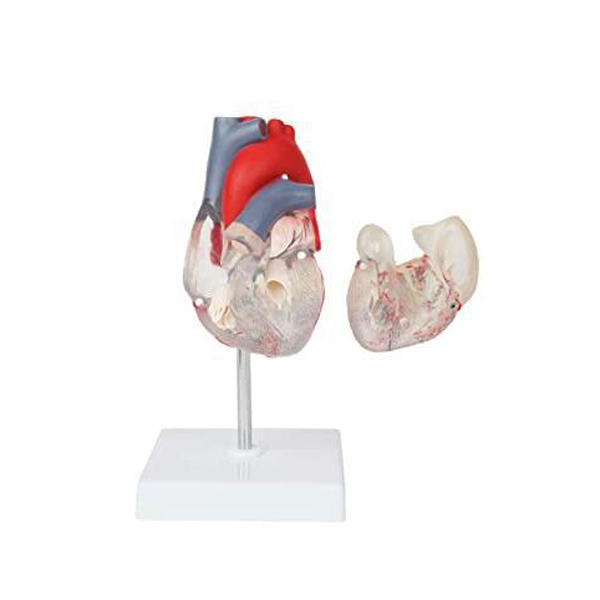 解剖心脏模型