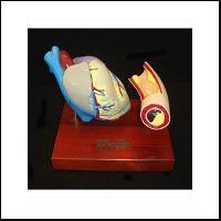 心脏动脉阻塞模型