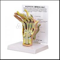 手关节炎模型